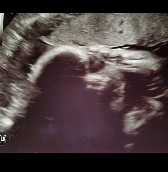 Meet your Posher, Adriana - Picture 1 of 1